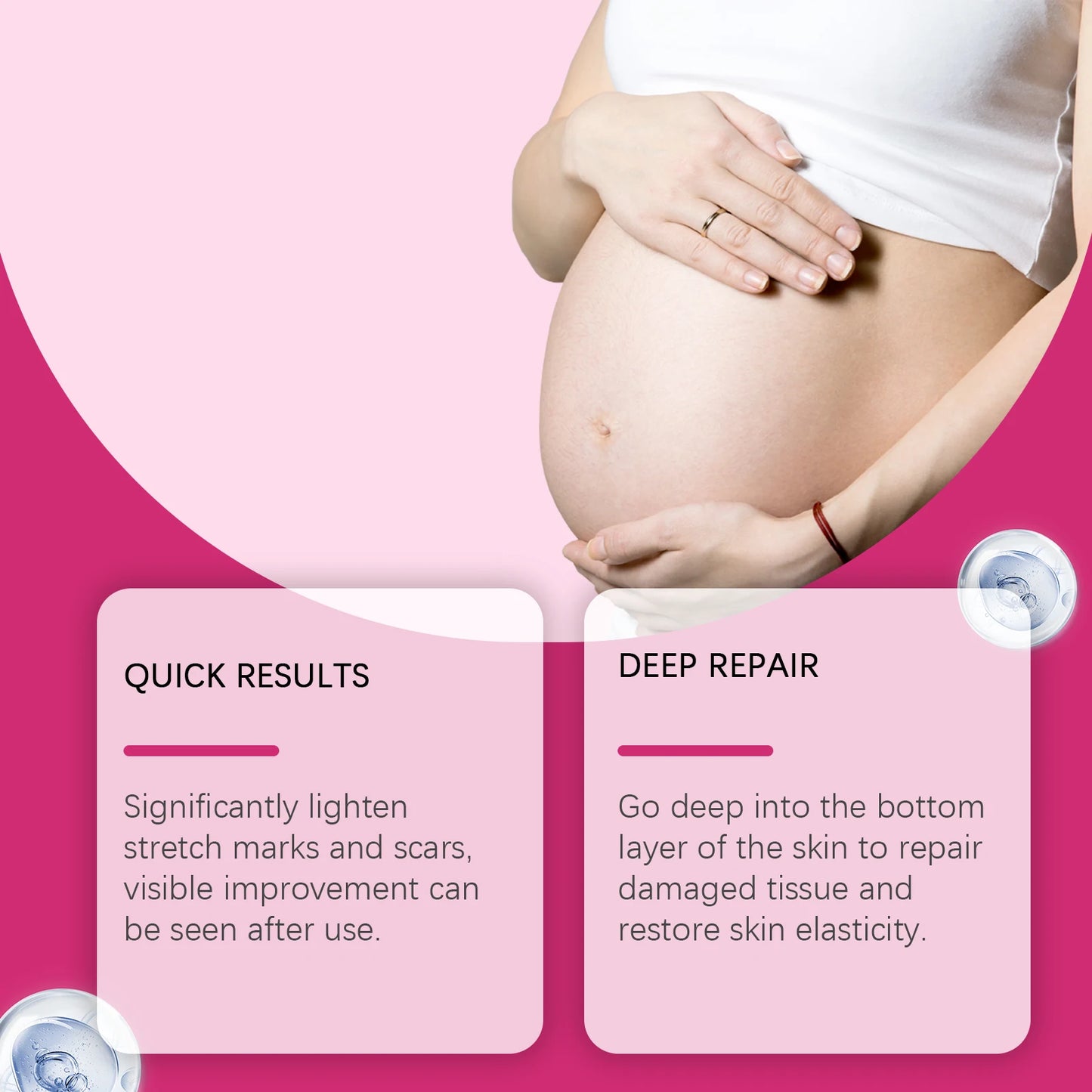 Eelhoe Pregnancy Stretch Marks Removal Lotion Nourishing Skin Care