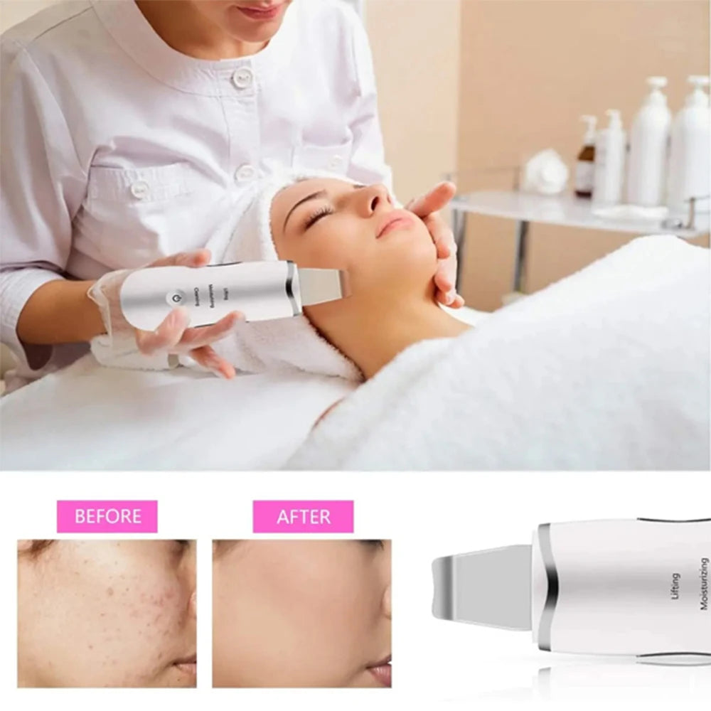 Ultrasonic Skin Scrubber 3 In 1 Facial Cleaner Massager