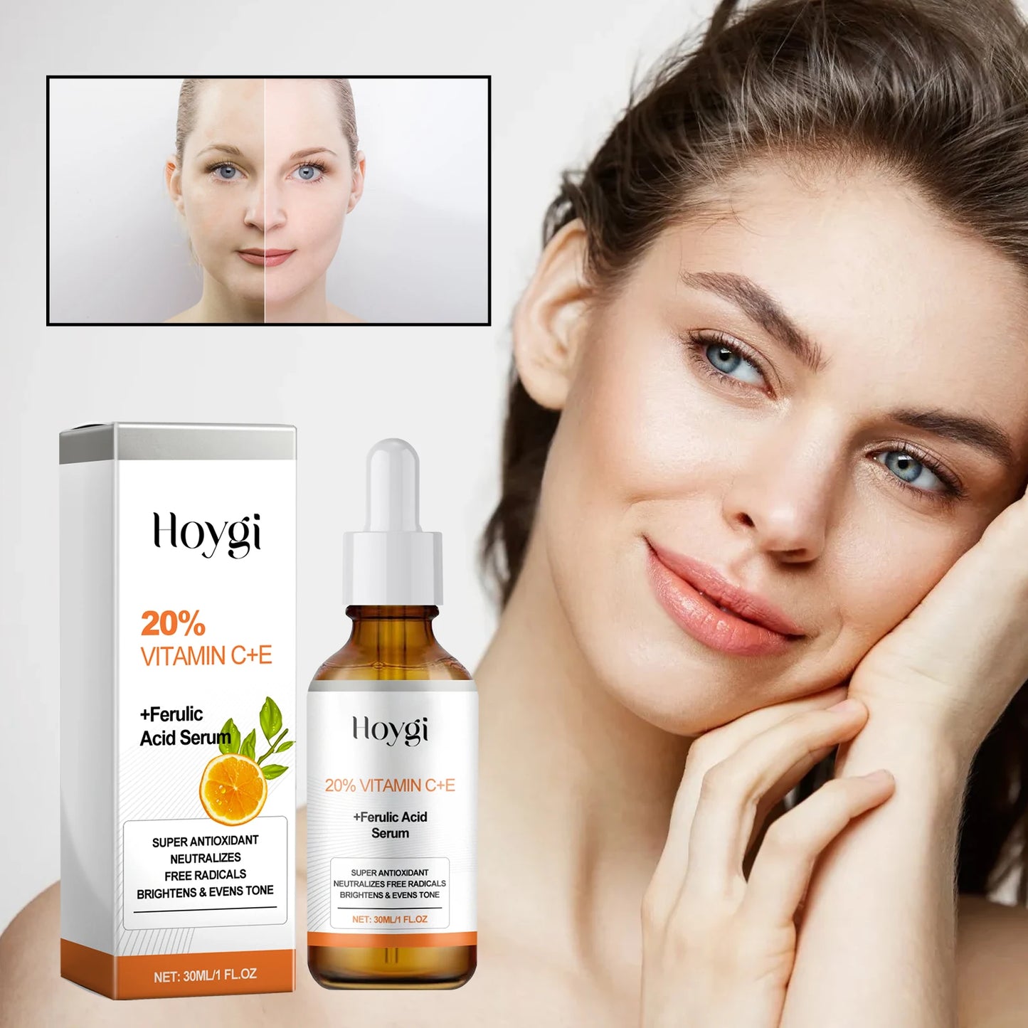 Hoygi Vitamin C E Ferulic Facial Serum for Pigmentation Reduction