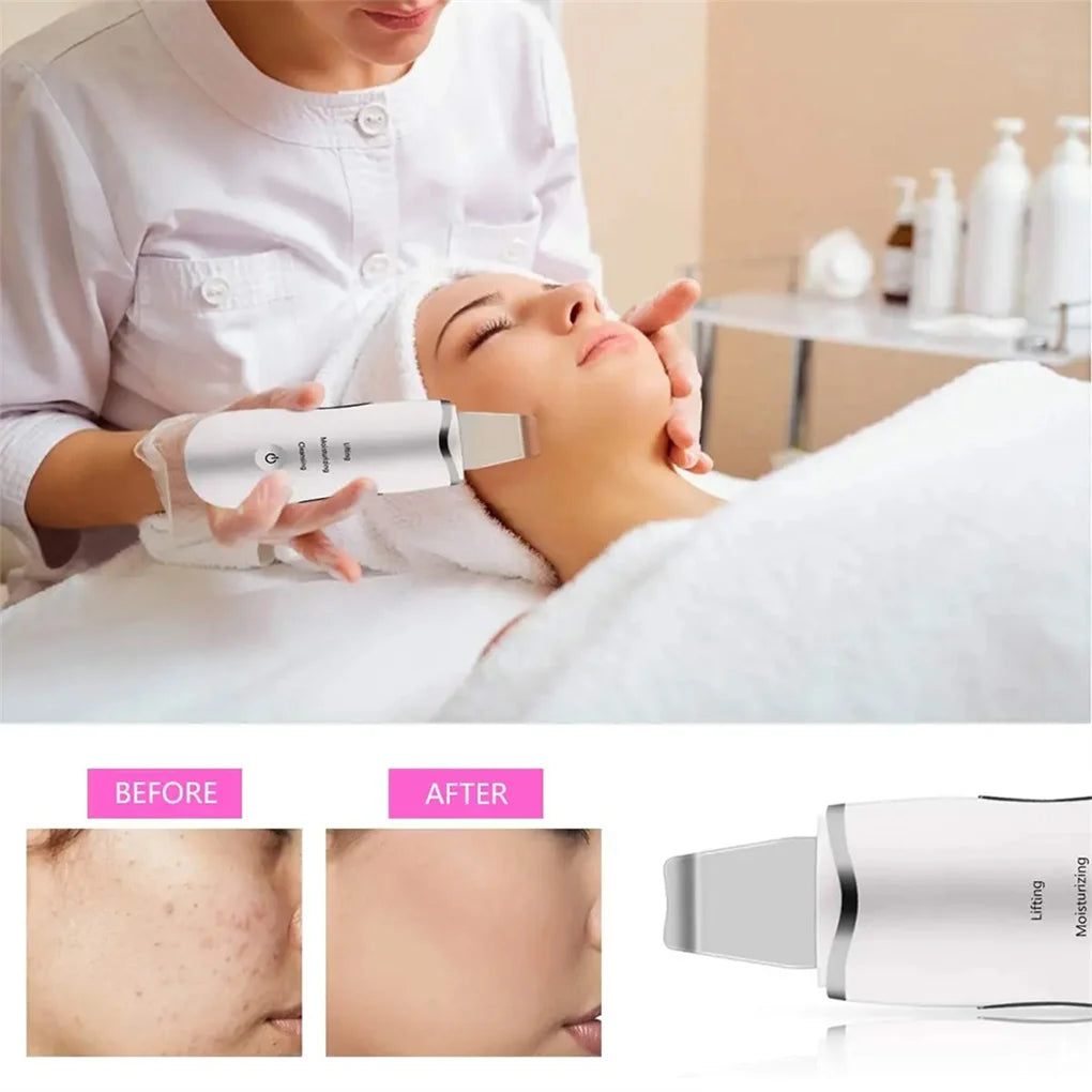 Ultrasonic Facial Spatula Deep Cleansing Electric Scrubber