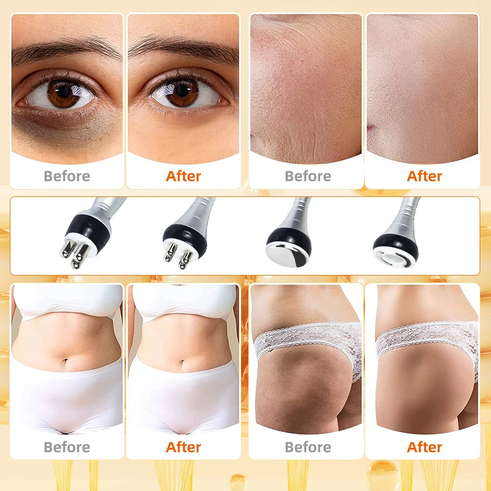 Ultrasonic Slimming Machine Facial Massager For Skin Tightening