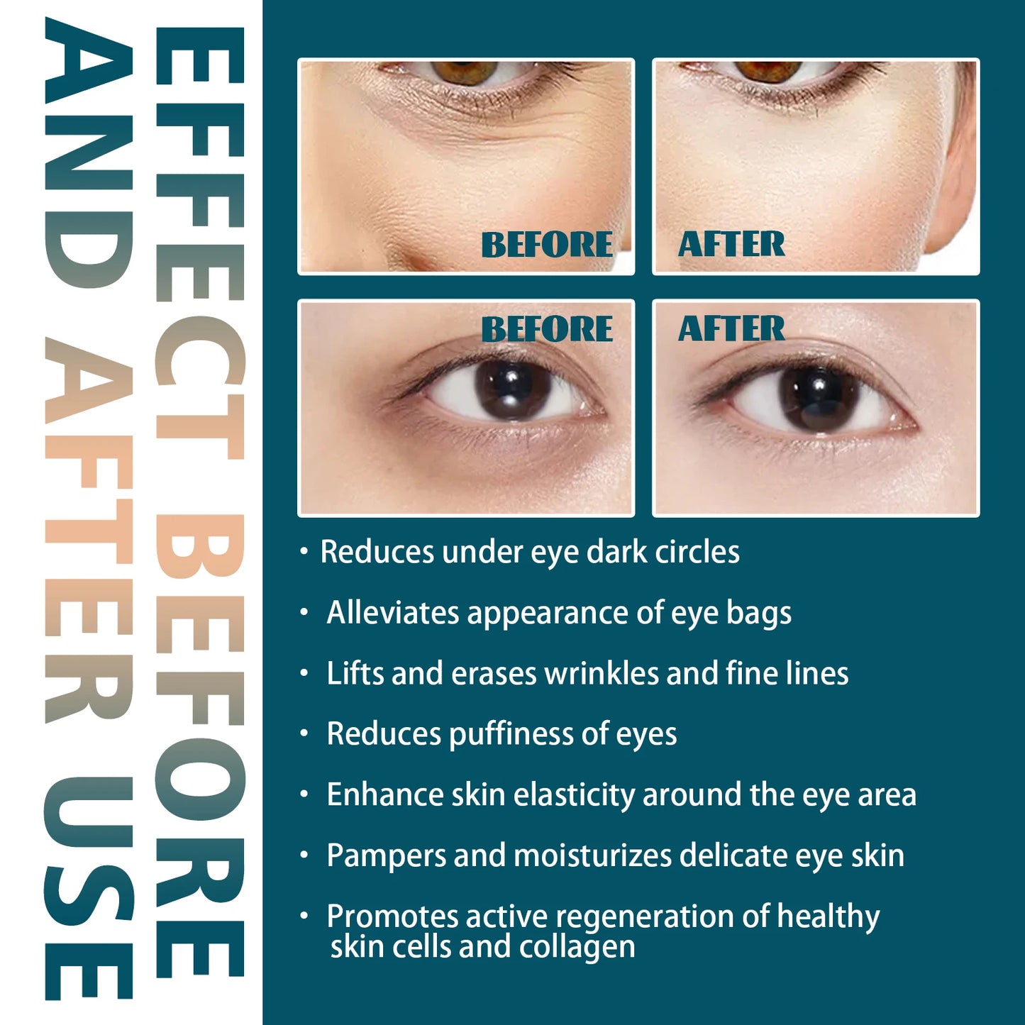 Eelhoe Retinol Collagen Eye Cream Firming Dark Circles