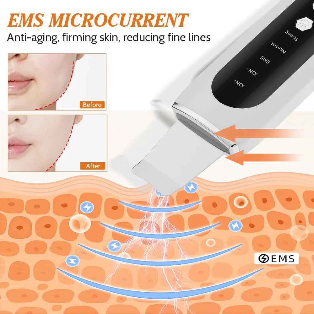 Ultrasonic Face Skin Scrubber Deep Pore Cleaner Pro