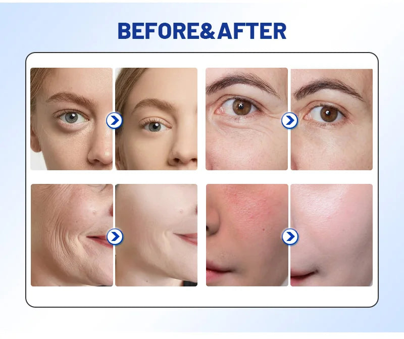 Slimming Portable Skin Tightening Device For Beauty Centers