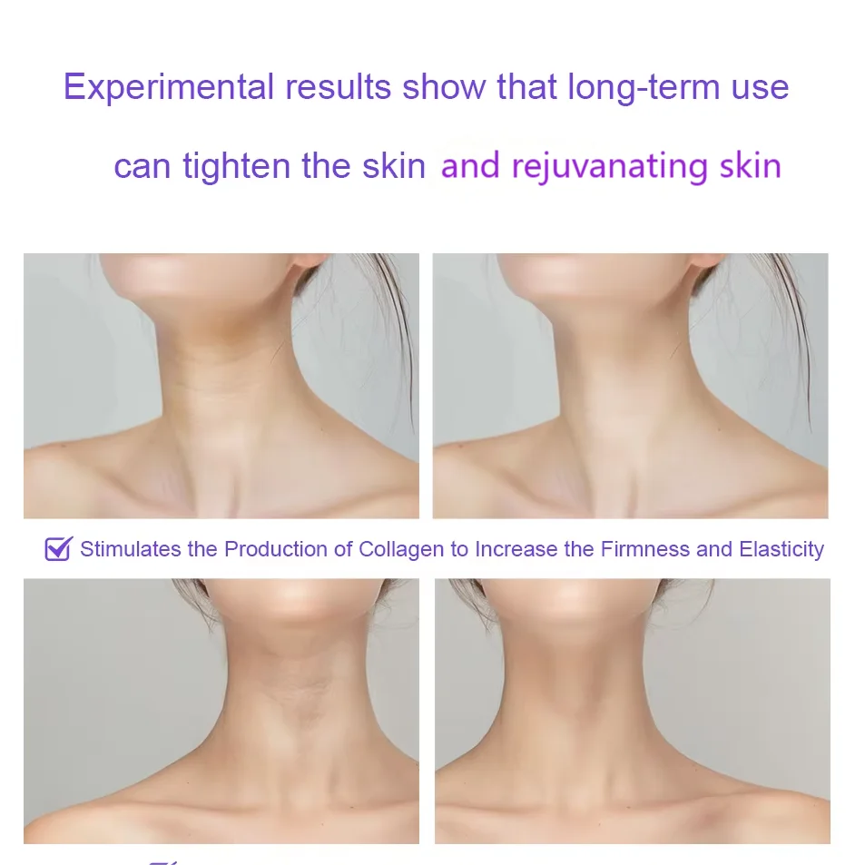 Yongrow 3in1 LED Hot Cold Face Neck Lifting Tightening Device