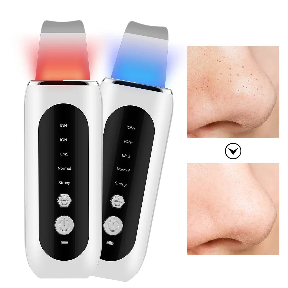 Ultrasonic Face Skin Scrubber Deep Pore Cleaner Pro