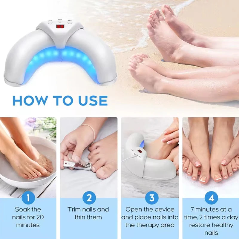 KTS Fungal Nail Laser Device For Toenail And Foot Care
