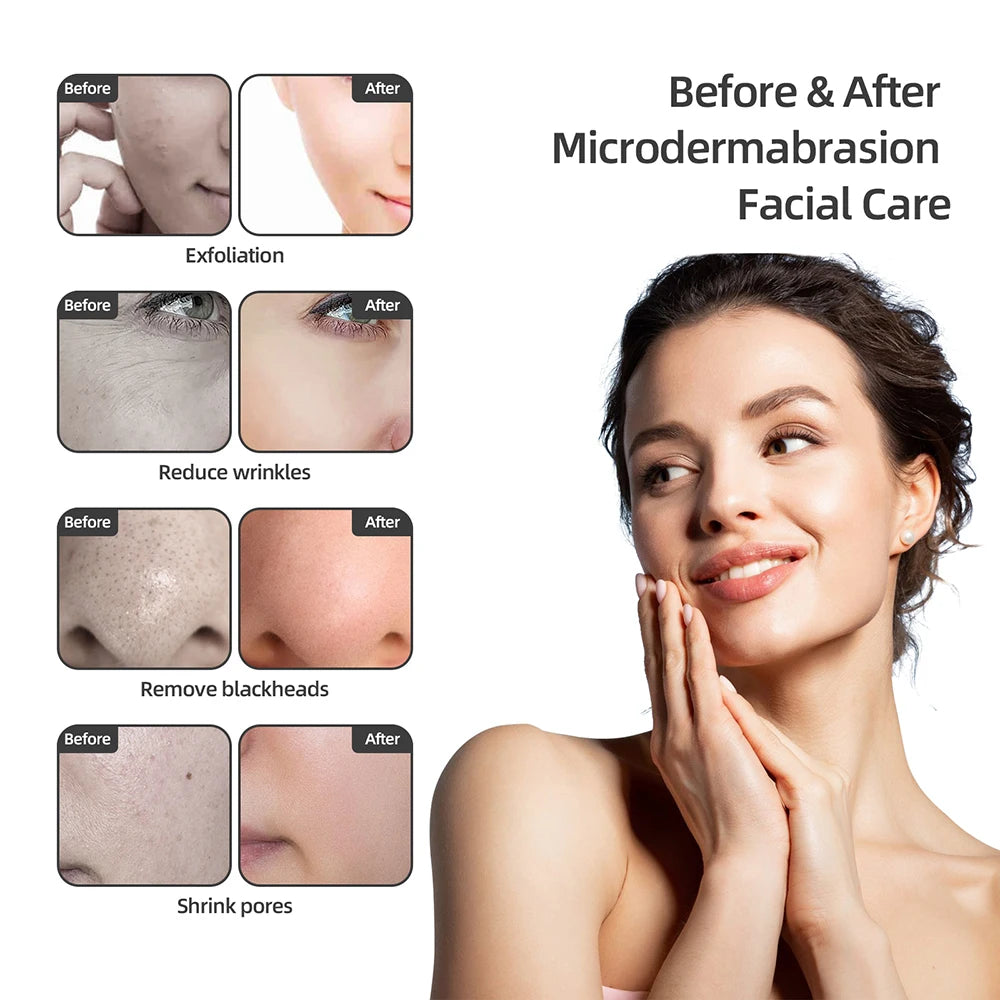 Foreverlily Professional Diamond Microdermabrasion Machine Water Spray