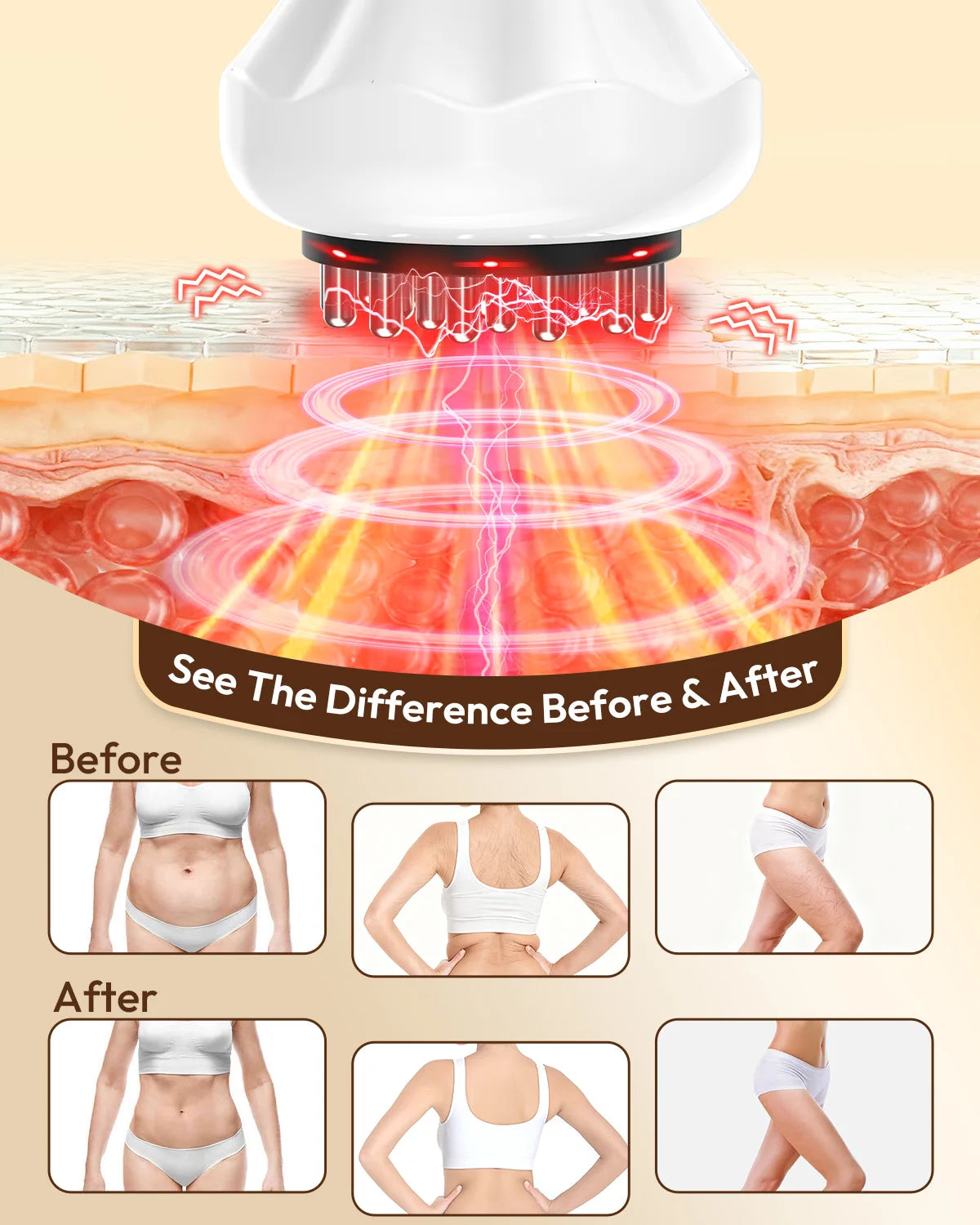 Lymphatic Drainage Massager and Anti Cellulite Sculpting Tool