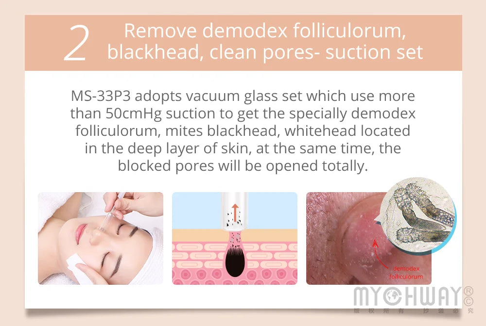 Mychway 3 in 1 Ultrasound Dermabrasion Facial Device